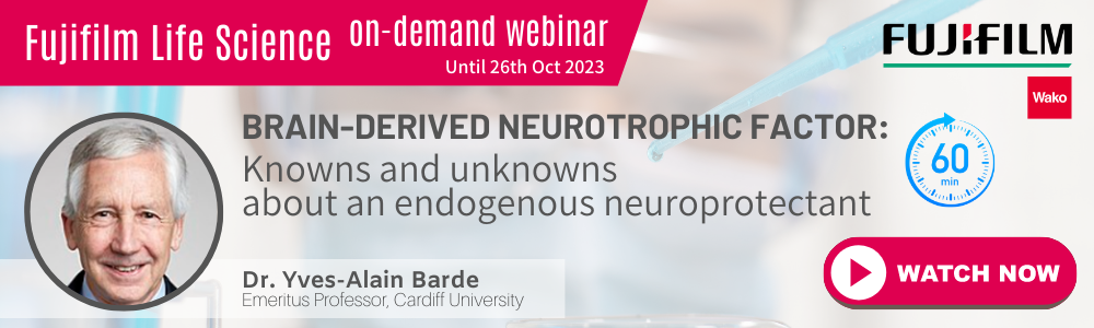[On-demand Webinar] Brain-derived neurotrophic factor:<br>Knowns and unknowns about an endogenous neuroprotectant<br>Speaker: Dr. Yves-Alain Barde | Emeritus Professor, Cardiff University