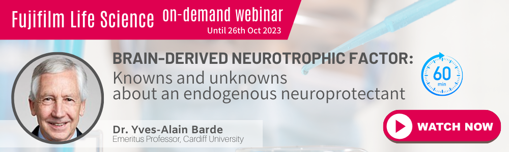 [On-demand Webinar] Brain-derived neurotrophic factor:<br>Knowns and unknowns about an endogenous neuroprotectant<br>Speaker: Dr. Yves-Alain Barde | Emeritus Professor, Cardiff University