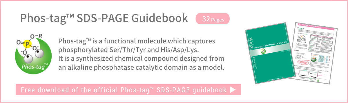 [Phos-tag™ SDS-PAGE] Free Guidebook Download