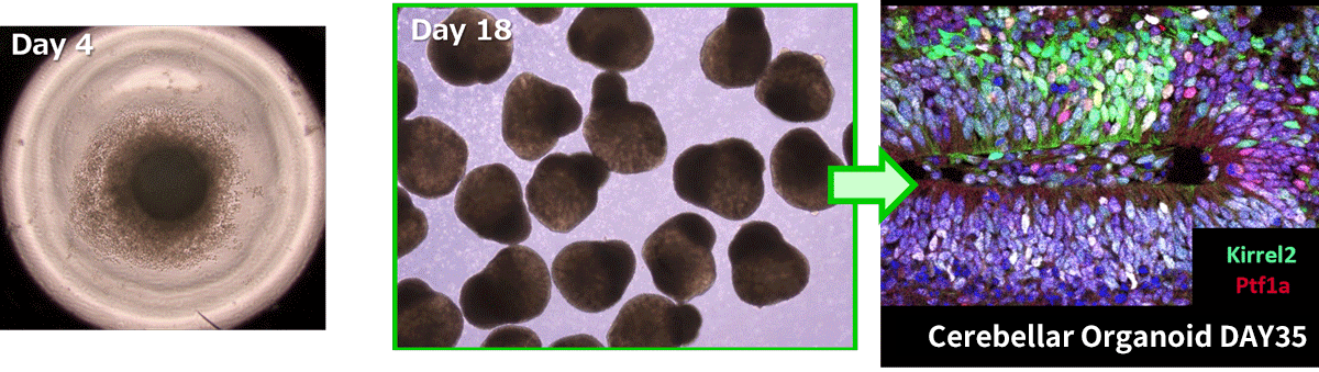 image:Cerebellar