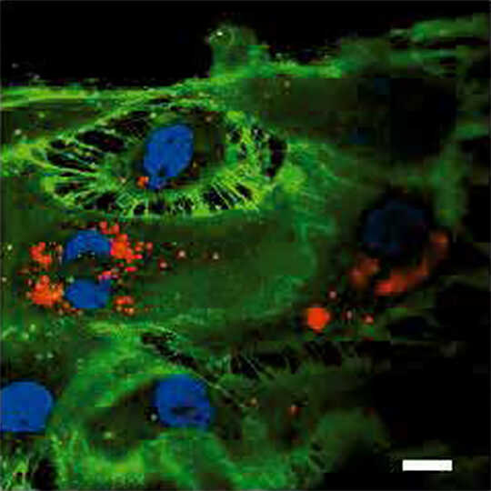  iPS細胞 [253G4] 由来の血管内皮細胞:iMatrix-411を用いた血管内皮細胞への分化誘導