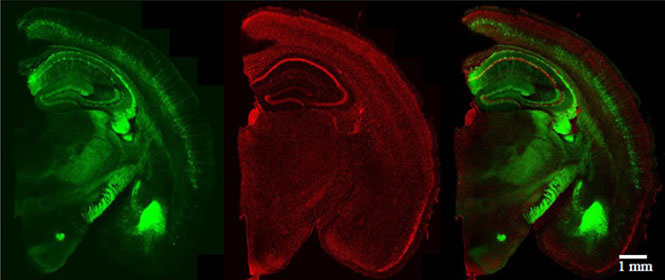 Propidium Iodide (PI) Staining and Clearing of Brain Hemisphere Sections from YFP-H Mice
