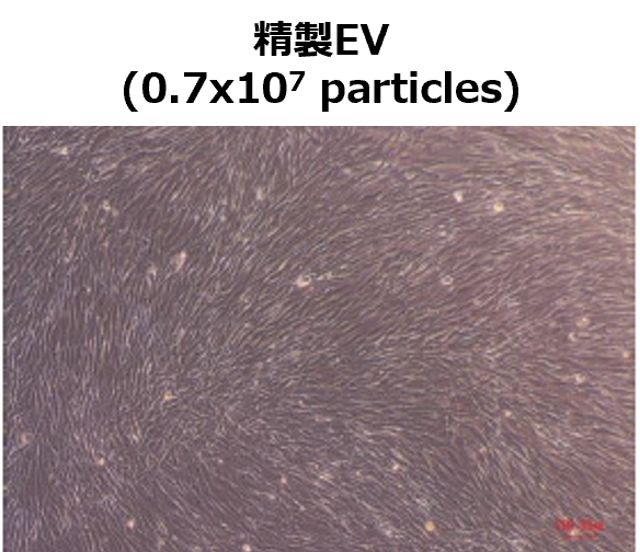 精製EV(0.7x107 particles)