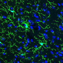 抗Iba1, ウサギモノクローナル抗体(6A4), 組換え体を用いたマウス大脳皮質ミクログリアの免疫組織染色