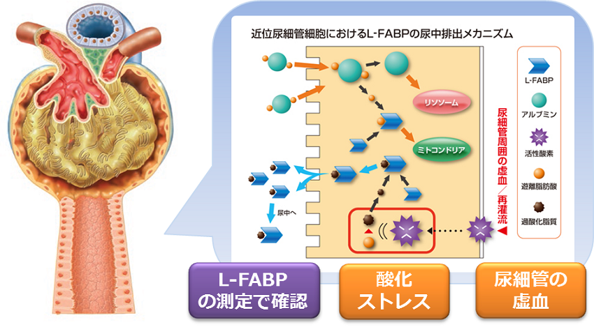 シミックホールディングス L型脂肪酸結合タンパク L Fabp 測定キット ライフサイエンス 製品情報 試薬 富士フイルム和光純薬