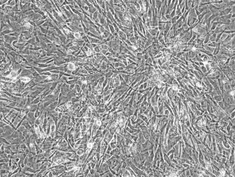 間 葉 系 幹細胞