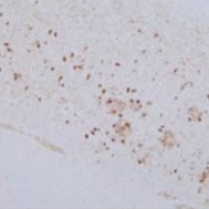 抗りん酸化Tau T181, ラットモノクローナル抗体(2E2-A6)