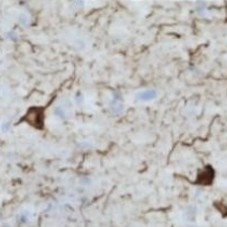 抗りん酸化Tau T181, ラットモノクローナル抗体(2E2-A6)