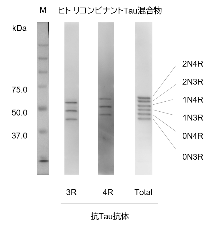 アイソフォームの検出