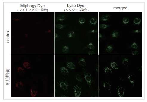 飢餓培養細胞での検出例