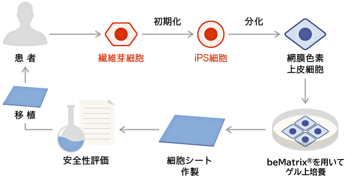 コラーゲンゲル培養