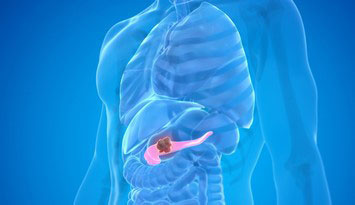 膵臓オルガノイド