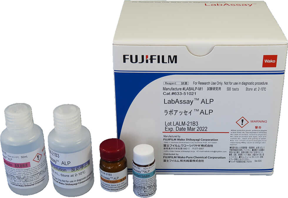 アルカリホスファターゼレベル検査のリスクは何ですか?