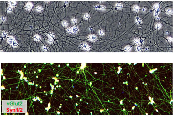 iCell  Induced Excitatory Neurons の形態 (A) および興奮性神経マーカーの発現 (B)