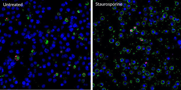 Jurkat細胞でのアポトーシス細胞とネクローシス細胞の検出