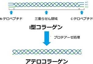 アテロコラーゲン