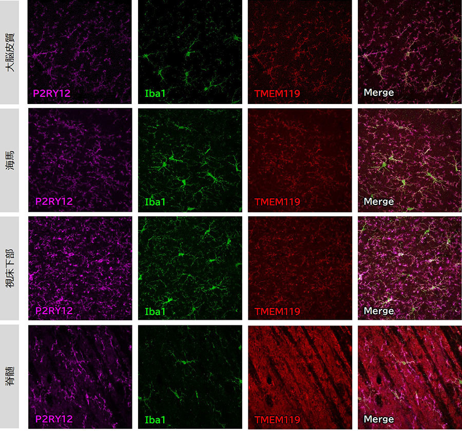 抗Iba1抗体および抗TMEM119抗体との比較