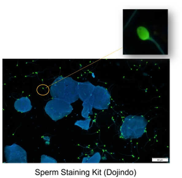 比較イメージ:Spem Staining Kit(Dojindo)