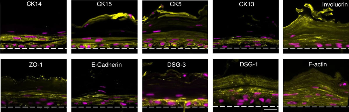 組織特異的マーカー