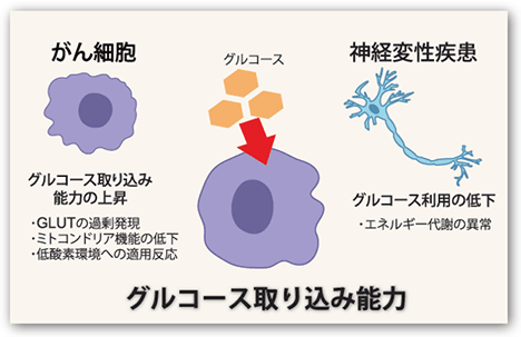 グルコース取り込みと疾患の関連について