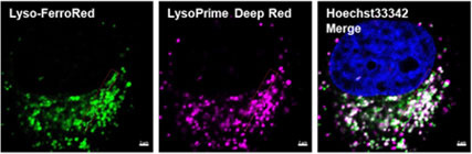 蛍光顕微鏡によるリソソーム局在のイメージング