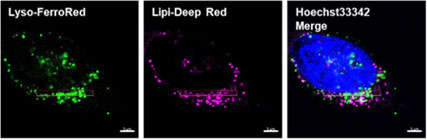 蛍光顕微鏡によるリソソーム局在のイメージング