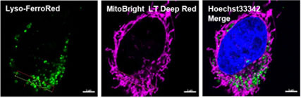 蛍光顕微鏡によるリソソーム局在のイメージング