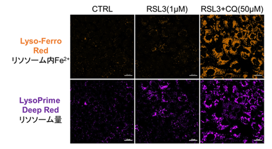 RSL3とCQ処理後の細胞イメージング