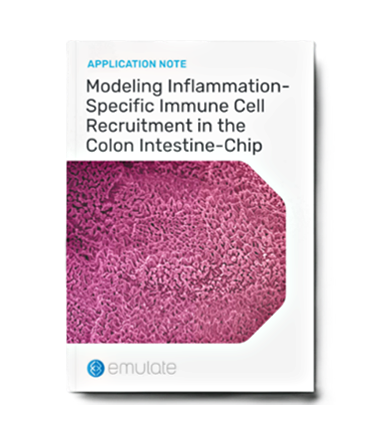 Modeling Inflammation-Specific Immune Cell Recruitment in the Colon Intestine-Chip
