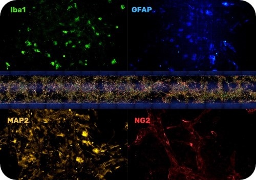 NVU の適切な組織化