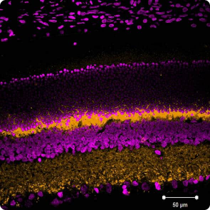 各製品の染色結果 VGLUT1