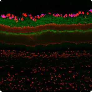 各製品の染色結果 SYT1