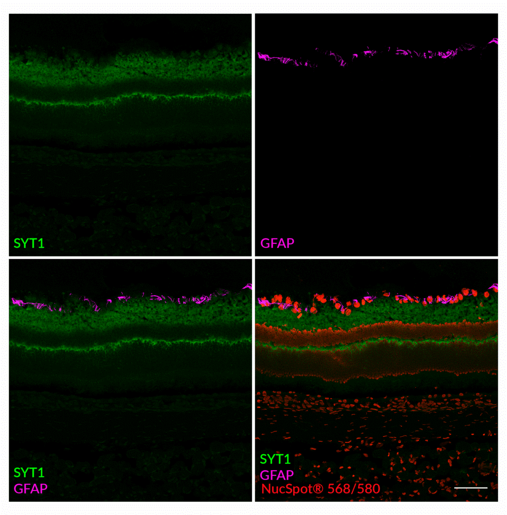 GFAP Recombinant Alpaca VHHの染色結果