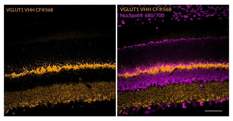 VGLUT1 Recombinant Alpaca VHHの染色結果