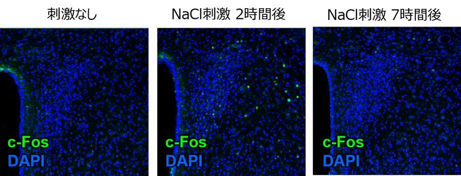 [免疫組織染色]腹腔内への高張食塩水投与によるc-Fos発現の時間経過