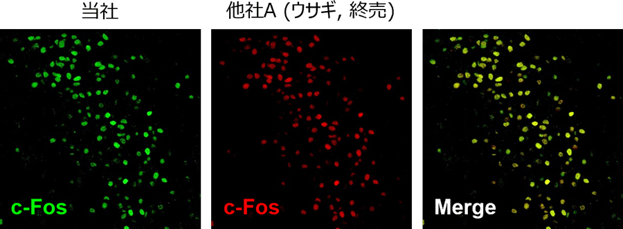 [免疫組織染色]比較 - 他社A (ウサギ, 終売)