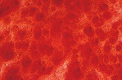 Alizarin Red S