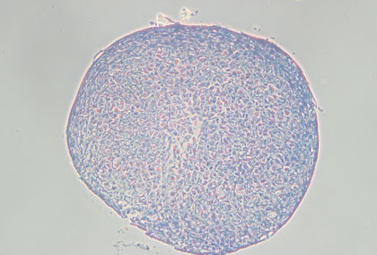 Toluidine Blue