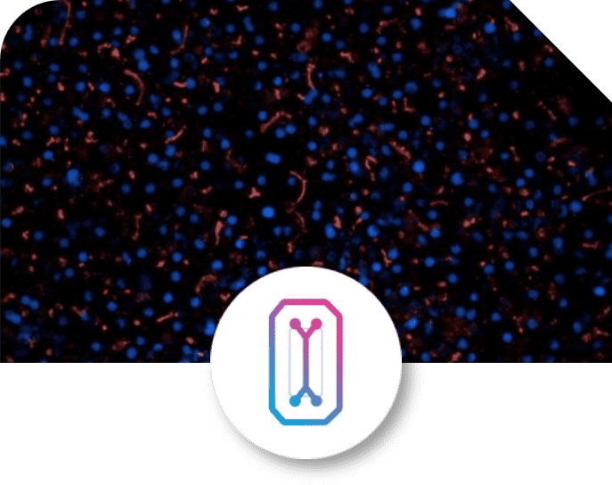 Chip-R1™ Rigid Chip