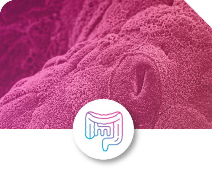 Colon Intestine-Chip