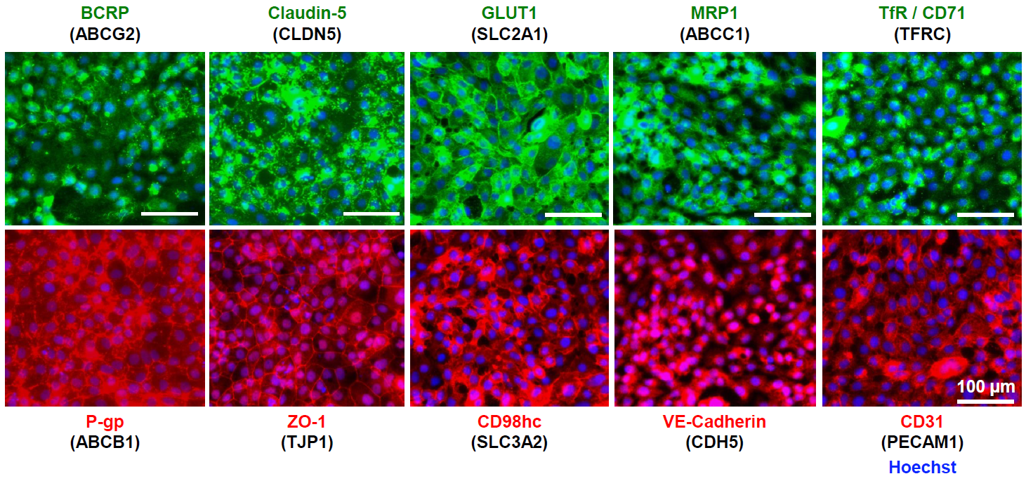 脳血管内皮細胞 マーカーの発現 (B)