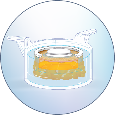 HypoSkin 経皮投与