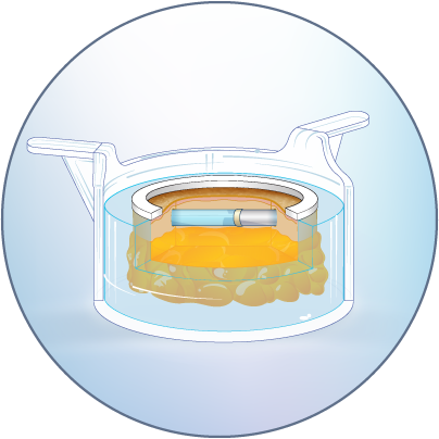 HypoSkin 輸液デバイス投与