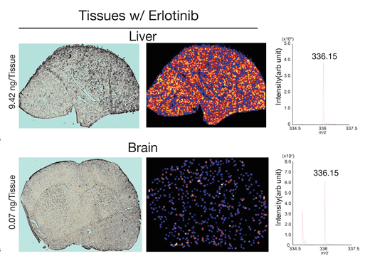エルロチニブの肝臓と脳内における質量分析イメージング Tissue