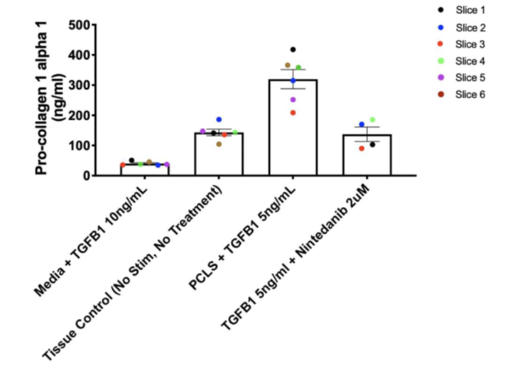 図. ヒトPCLSに対するTGFβ1刺激により、Pro-collagen1α1が誘導された。またNintedanibによりPro-collagen1α1の誘導が抑制された。