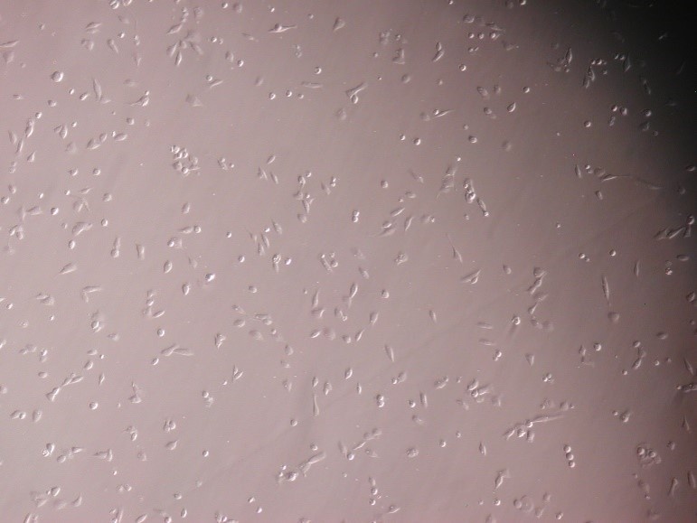 例：ヒト軟骨細胞