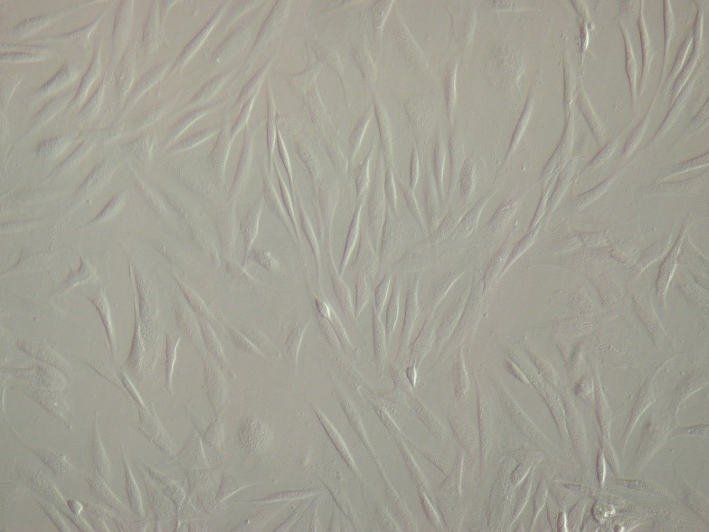 例：ヒト滑膜線維芽細胞