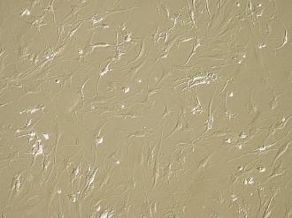 例：ヒト滑膜細胞