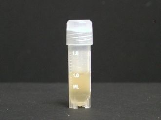 例：ヒト滑膜液