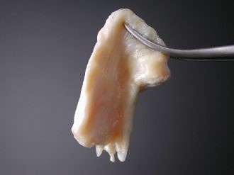 例：人間の膝蓋腱組織